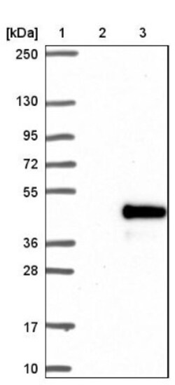 CRX/CORD2 Antibody, Novus Biologicals 25 &mu;L; Unlabeled:Antibodies, Polyclonal
