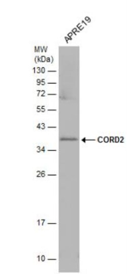 CRX/CORD2 Antibody, Novus Biologicals 0.1mL; Unlabeled:Antibodies, Polyclonal