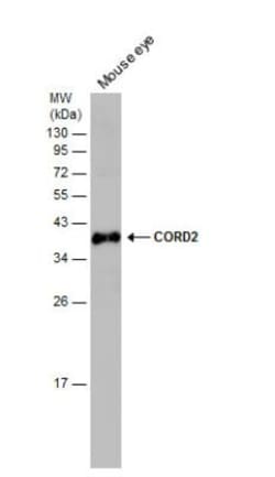 CRX/CORD2 Antibody, Novus Biologicals 0.1mL; Unlabeled:Antibodies, Polyclonal