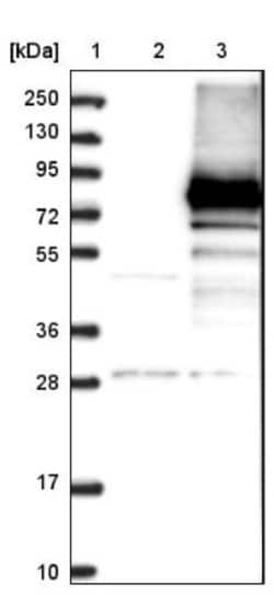 CRY2 Antibody, Novus Biologicals 25 &mu;L; Unlabeled:Antibodies, Polyclonal