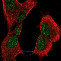 CRYBB2 Antibody, Novus Biologicals:Antibodies:Primary Antibodies
