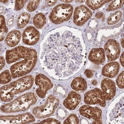 CRYGN Antibody, Novus Biologicals 0.1mL; Unlabeled:Antibodies, Polyclonal