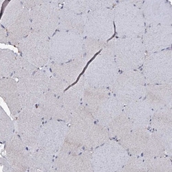 CRYL1 Antibody, Novus Biologicals 0.1mL; Unlabeled:Antibodies, Polyclonal