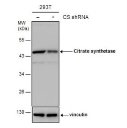 CS Citrate Synthase Antibody (1761), Novus Biologicals 0.1mL; Unlabeled:Antibodies