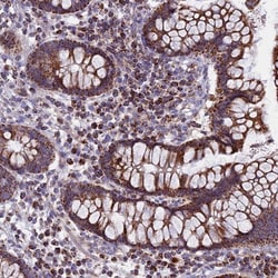 CS Citrate Synthase Antibody, Novus Biologicals:Antibodies:Primary Antibodies