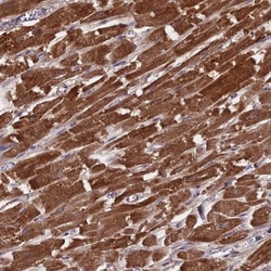CS Citrate Synthase Antibody, Novus Biologicals:Antibodies:Primary Antibodies