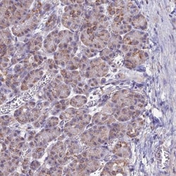 CS Citrate Synthase Antibody, Novus Biologicals:Antibodies:Primary Antibodies