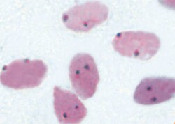 Abnova™ ROS1 Split CISH Probe