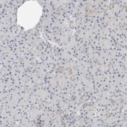 CSAP Antibody, Novus Biologicals:Antibodies:Primary Antibodies