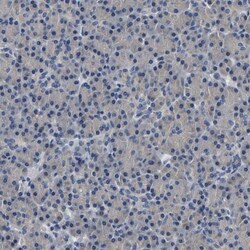 CSDE1 Antibody, Novus Biologicals 0.1mL; Unlabeled:Antibodies, Polyclonal