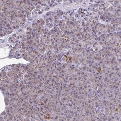 CSDE1 Antibody, Novus Biologicals 0.1 mL | Buy Online | Novus Biologicals | Fisher Scientific