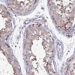 CSDE1 Antibody, Novus Biologicals 0.1 mL | Buy Online | Novus Biologicals | Fisher Scientific