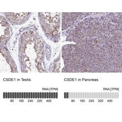 CSDE1 Antibody, Novus Biologicals 0.1 mL | Buy Online | Novus Biologicals | Fisher Scientific