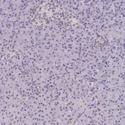 CSE1L/CAS/Exportin-2 Antibody, Novus Biologicals 25 &mu;L, Unlabeled:Antibodies,