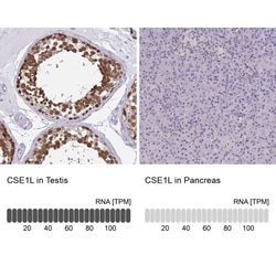 CSE1L/CAS/Exportin-2 Antibody, Novus Biologicals 25 &mu;L, Unlabeled:Antibodies,