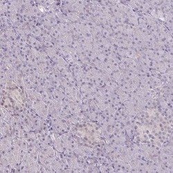 CSE1L/CAS/Exportin-2 Antibody, Novus Biologicals 0.1mL; Unlabeled:Antibodies,