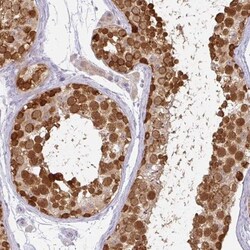 CSE1L/CAS/Exportin-2 Antibody, Novus Biologicals 0.1mL; Unlabeled:Antibodies,
