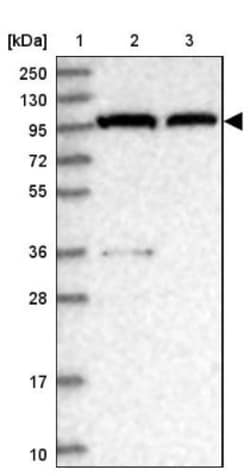 CSE1L/CAS/Exportin-2 Antibody, Novus Biologicals 25 &mu;L, Unlabeled:Antibodies,