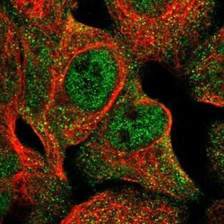 CSGLCAT Antibody, Novus Biologicals 25 &mu;L; Unlabeled:Antibodies, Polyclonal