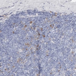 CSK Antibody, Novus Biologicals 0.1mL; Unlabeled:Antibodies, Polyclonal