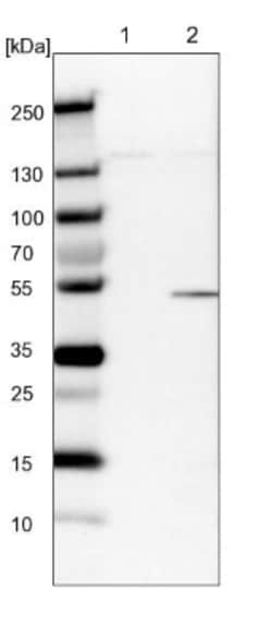 CSK Antibody, Novus Biologicals 0.1mL; Unlabeled:Antibodies, Polyclonal