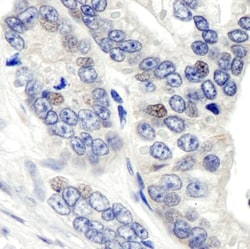CSN1 Antibody, Novus Biologicals 0.1mg; Unlabeled:Antibodies, Polyclonal