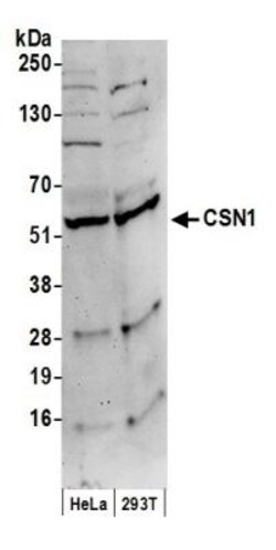 CSN1 Antibody, Novus Biologicals 0.1mg; Unlabeled:Antibodies, Polyclonal
