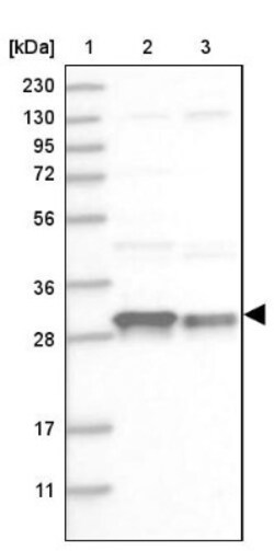 CSN7b Antibody, Novus Biologicals:Antibodies:Primary Antibodies