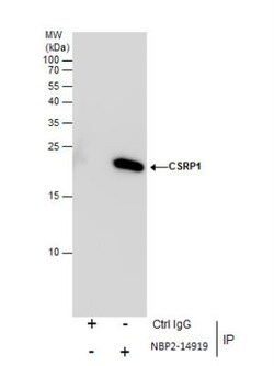 CSRP1 Antibody, Novus Biologicals 0.1mL; Unlabeled:Antibodies, Polyclonal