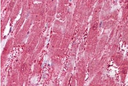 CSRP3 Antibody, Novus Biologicals 0.1mg; Unlabeled:Antibodies, Polyclonal