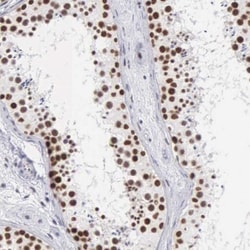 Cleavage stimulation factor 2 Antibody, Novus Biologicals 0.1mL; Unlabeled:Antibodies,