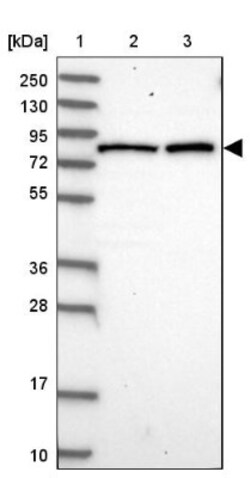 CSTF3 Antibody, Novus Biologicals 25 &mu;L | Buy Online | Novus Biologicals | Fisher Scientific