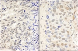 CTCF Antibody, Novus Biologicals 0.1mL; Unlabeled:Antibodies, Polyclonal