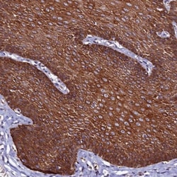 CTDSPL2 Antibody, Novus Biologicals 0.1mL; Unlabeled:Antibodies, Polyclonal
