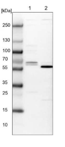 CTDSPL2 Antibody, Novus Biologicals 0.1mL; Unlabeled:Antibodies, Polyclonal