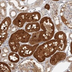 CTIF Antibody, Novus Biologicals:Antibodies:Primary Antibodies