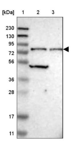 CTIF Antibody, Novus Biologicals:Antibodies:Primary Antibodies