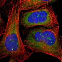 CTTNBP2NL Antibody, Novus Biologicals 25 &mu;L; Unlabeled:Antibodies, Polyclonal