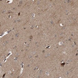 SEMA3D Antibody, Novus Biologicals:Antibodies:Primary Antibodies