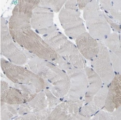 CUL4B Antibody, Novus Biologicals 25 &mu;L | Buy Online | Novus Biologicals | Fisher Scientific
