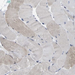 CUL4B Antibody, Novus Biologicals 25 &mu;L | Buy Online | Novus Biologicals | Fisher Scientific