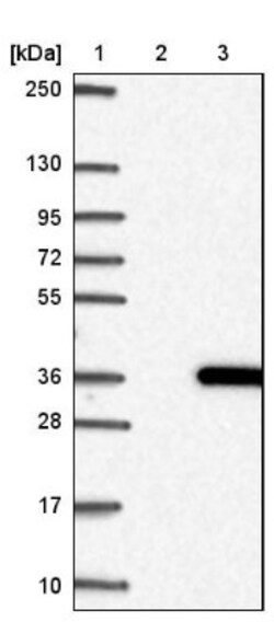 CUTC Antibody, Novus Biologicals 25 &mu;L; Unlabeled:Antibodies, Polyclonal