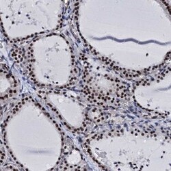 CWC15 Antibody, Novus Biologicals 0.1mL; Unlabeled:Antibodies, Polyclonal