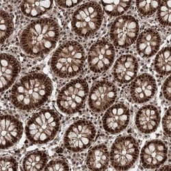 CWC22 Antibody, Novus Biologicals:Antibodies:Primary Antibodies