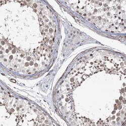 CWF19L1 Antibody, Novus Biologicals 0.1mL; Unlabeled:Antibodies, Polyclonal