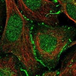 CXADR Antibody, Novus Biologicals 0.1mL; Unlabeled:Antibodies, Polyclonal