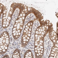 CXADR Antibody, Novus Biologicals 0.1mL; Unlabeled:Antibodies, Polyclonal