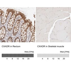 CXADR Antibody, Novus Biologicals 0.1mL; Unlabeled:Antibodies, Polyclonal
