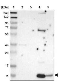 CXCL7/NAP-2 Antibody, Novus Biologicals:Antibodies:Primary Antibodies