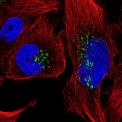 CXCL8/IL-8 Antibody, Novus Biologicals:Antibodies:Primary Antibodies